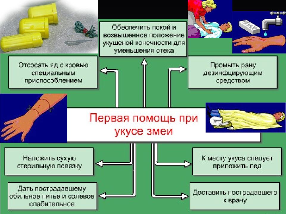 Укусы змей: первая помощь